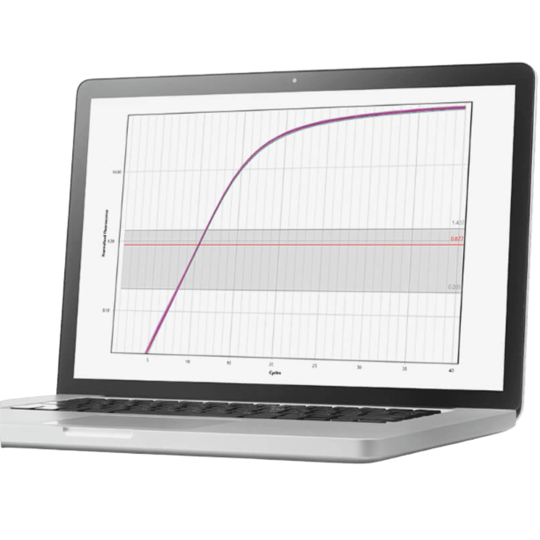 BMS-open-laptop