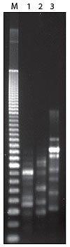 Epicentre-g_qexplant_pcrproducts