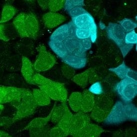 Tech Tip: Using ViaFluor® SE Stains for Cell Tracing and Co-Culture