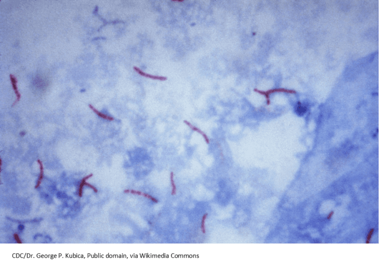 MTB-Ziehl-Neelsen_stain